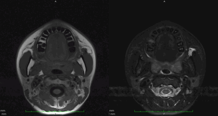 九州歯科大学 画像診断学分野 62期 研究室配属 H24年度